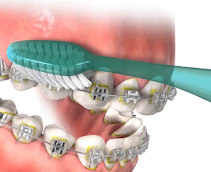 Charter Method Image