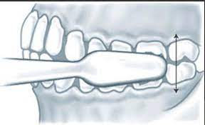 Vertical Method Image