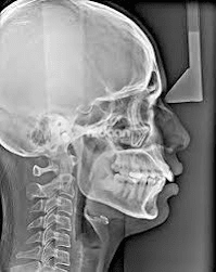 Oral Cephalogram Image