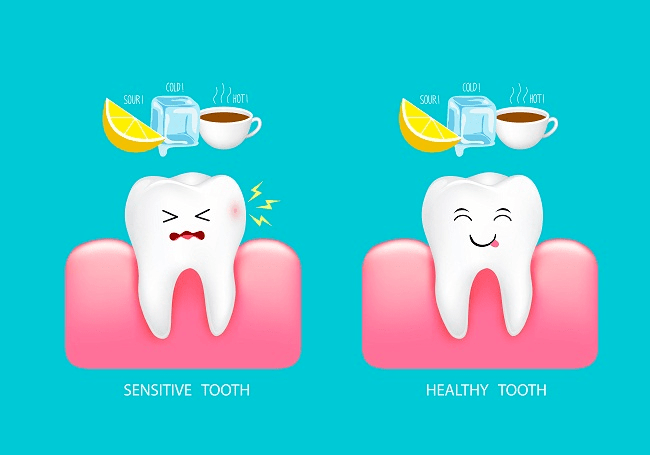 Teeth Sensitivity Image